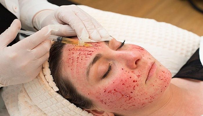 Facial