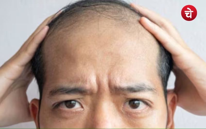 Hair