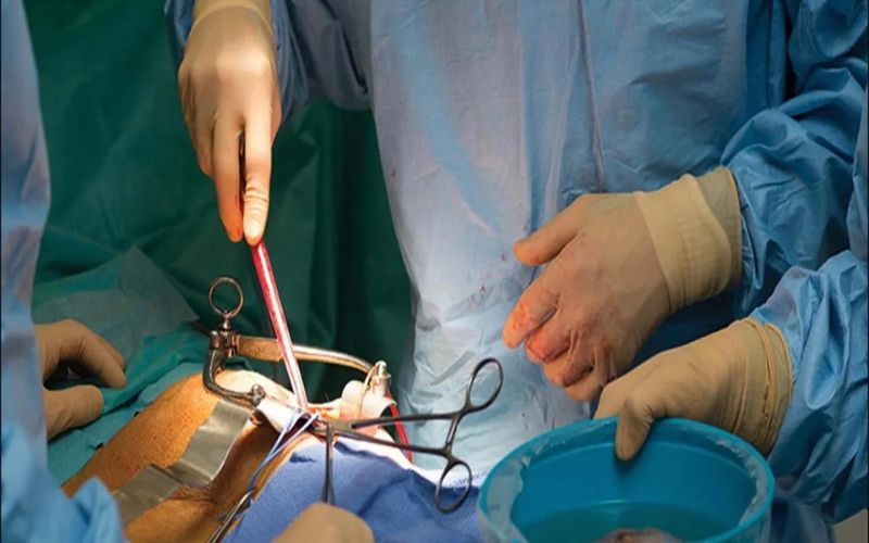 Kidney Racket