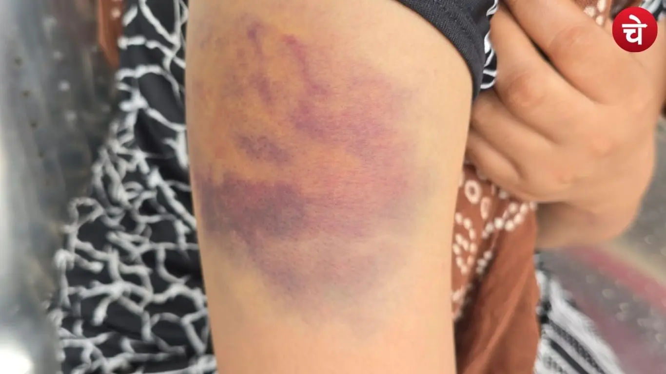 A woman who is a victim of her husband abuse
